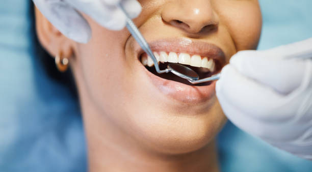 Best Emergency Root Canal Treatment in Port Edwards, WI